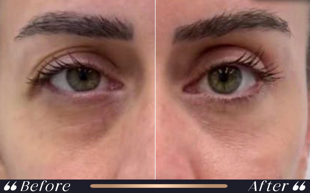 Facial Aesthetics consultation at Yesilkoy Clinic