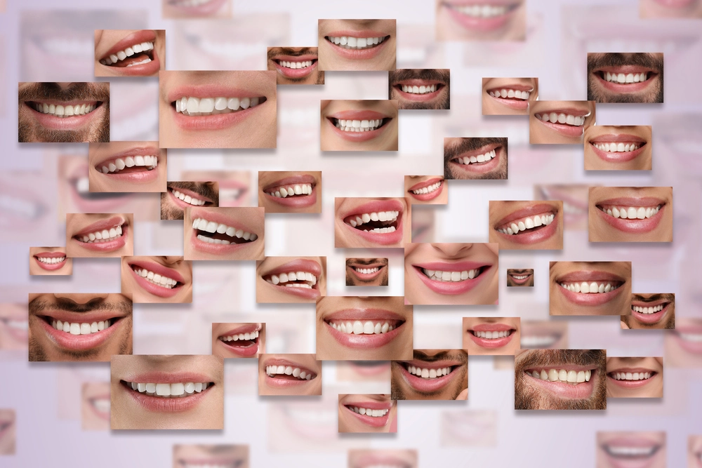 Dental Aesthetics in Istanbul