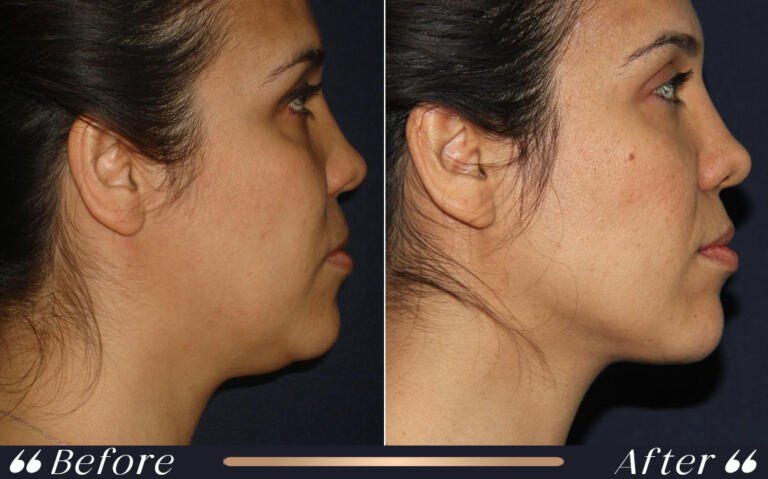 face_and_neck_2 (1)