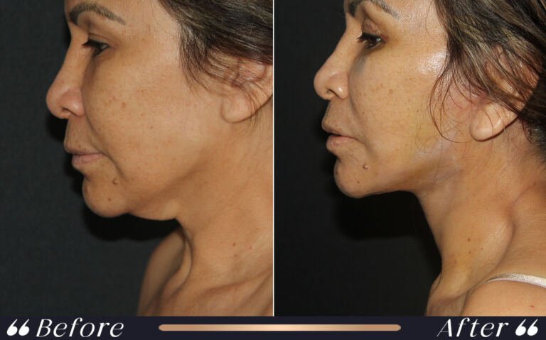 face_and_neck_7 (1)