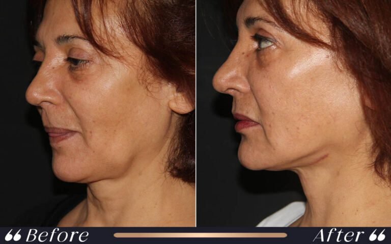 face_and_neck_8