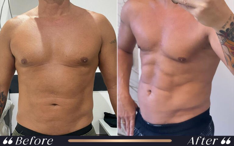 six_pack_8