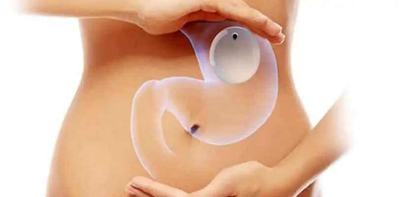 gastric balloon treatment in gastric balloon vs gastric sleeve comparison